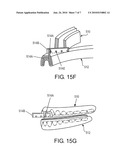 INTRA-ORAL APNEA AND SNORING PREVENTIONG APPLIANCE diagram and image