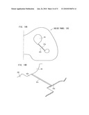 AIRBAG, AIRBAG DEVICE, AND VEHICLE diagram and image