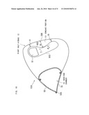 AIRBAG, AIRBAG DEVICE, AND VEHICLE diagram and image