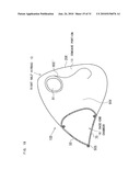 AIRBAG, AIRBAG DEVICE, AND VEHICLE diagram and image