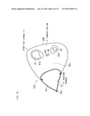 AIRBAG, AIRBAG DEVICE, AND VEHICLE diagram and image