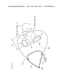 AIRBAG, AIRBAG DEVICE, AND VEHICLE diagram and image