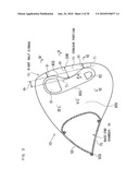 AIRBAG, AIRBAG DEVICE, AND VEHICLE diagram and image