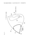 AIRBAG, AIRBAG DEVICE, AND VEHICLE diagram and image