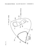 AIRBAG, AIRBAG DEVICE, AND VEHICLE diagram and image