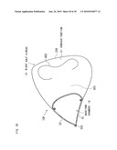 AIRBAG, AIRBAG DEVICE, AND VEHICLE diagram and image