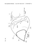 AIRBAG, AIRBAG DEVICE, AND VEHICLE diagram and image