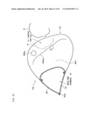 AIRBAG, AIRBAG DEVICE, AND VEHICLE diagram and image