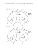 AIRBAG, AIRBAG DEVICE, AND VEHICLE diagram and image