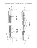 Vehicle capture and restraint device diagram and image