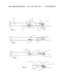 Vehicle capture and restraint device diagram and image