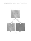 Methods and devices useful for analyzing color medical images diagram and image