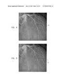 AUTOMATIC STABILIZATION OF AN IMAGE STREAM OF A MOVING ORGAN diagram and image