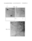 AUTOMATIC STABILIZATION OF AN IMAGE STREAM OF A MOVING ORGAN diagram and image