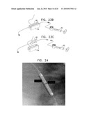 AUTOMATIC STABILIZATION OF AN IMAGE STREAM OF A MOVING ORGAN diagram and image