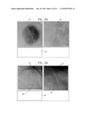 AUTOMATIC STABILIZATION OF AN IMAGE STREAM OF A MOVING ORGAN diagram and image