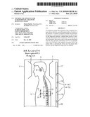 METHOD AND APPARATUS FOR ACQUISITION OF A MAGNETIC RESONANCE IMAGE diagram and image