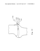 DRUG DEPOT IMPLANT DESIGNS AND METHODS OF IMPLANTATION diagram and image