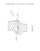 DRUG DEPOT IMPLANT DESIGNS AND METHODS OF IMPLANTATION diagram and image