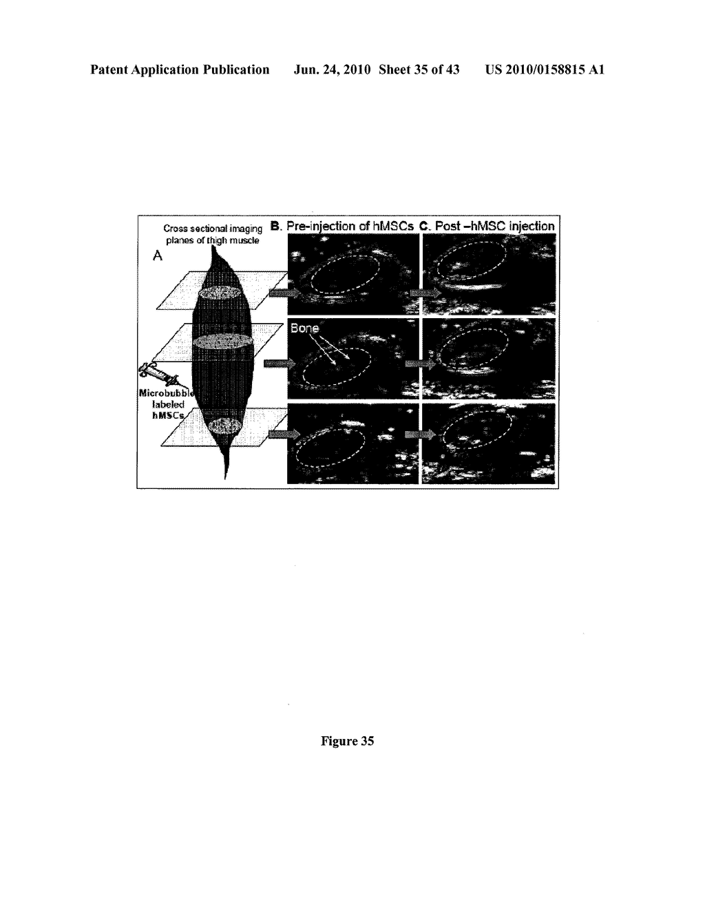 Biological Cell Tracking With Ultrasound - diagram, schematic, and image 36