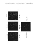 ANTIBODIES, METHODS AND KITS FOR DIAGNOSING AND TREATING MELANOMA diagram and image