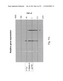 ANTIBODIES, METHODS AND KITS FOR DIAGNOSING AND TREATING MELANOMA diagram and image