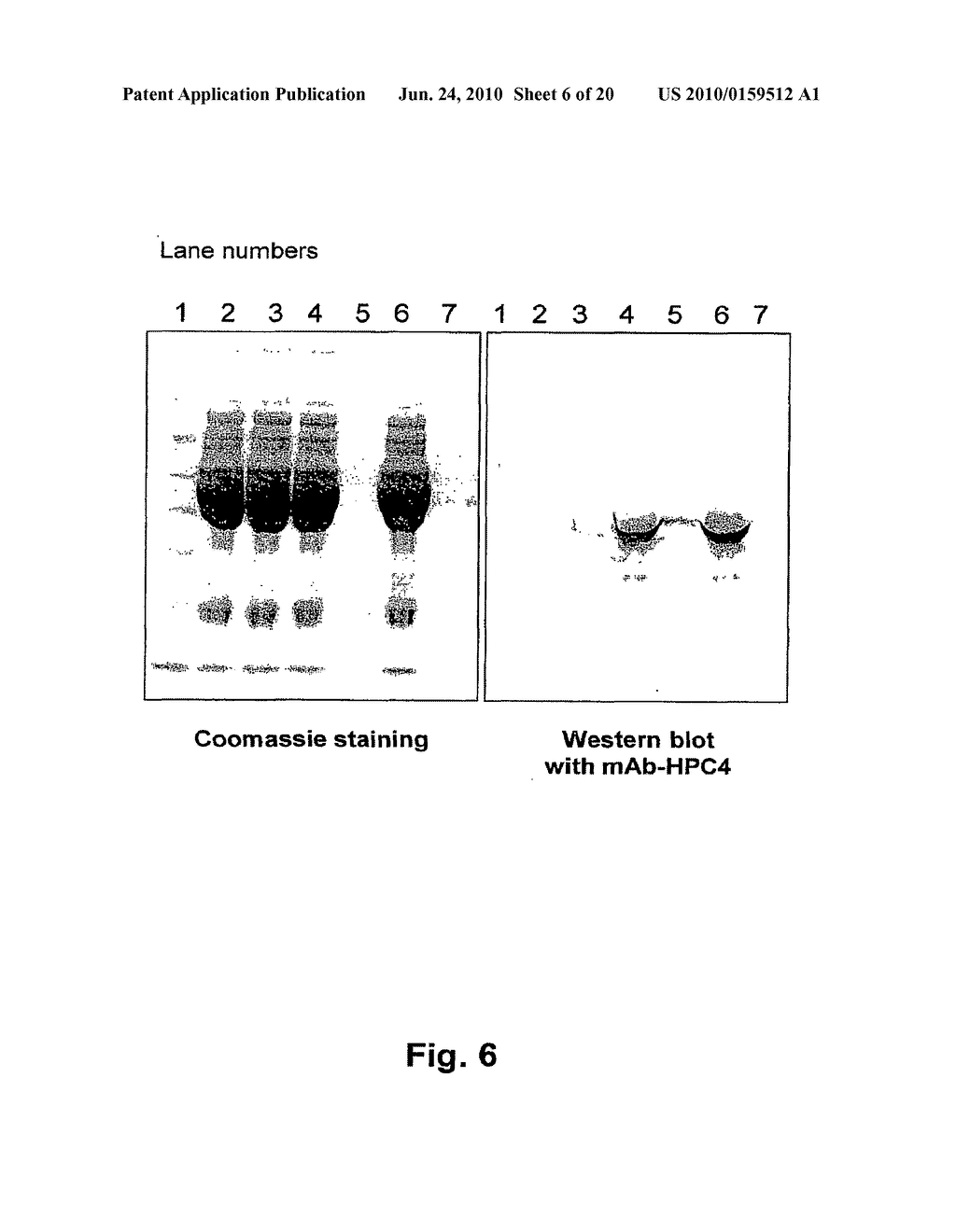 METHOD FOR THE PREPARATION OF RECOMBINANT HUMAN THROMBIN AND FIBRINOGEN - diagram, schematic, and image 07