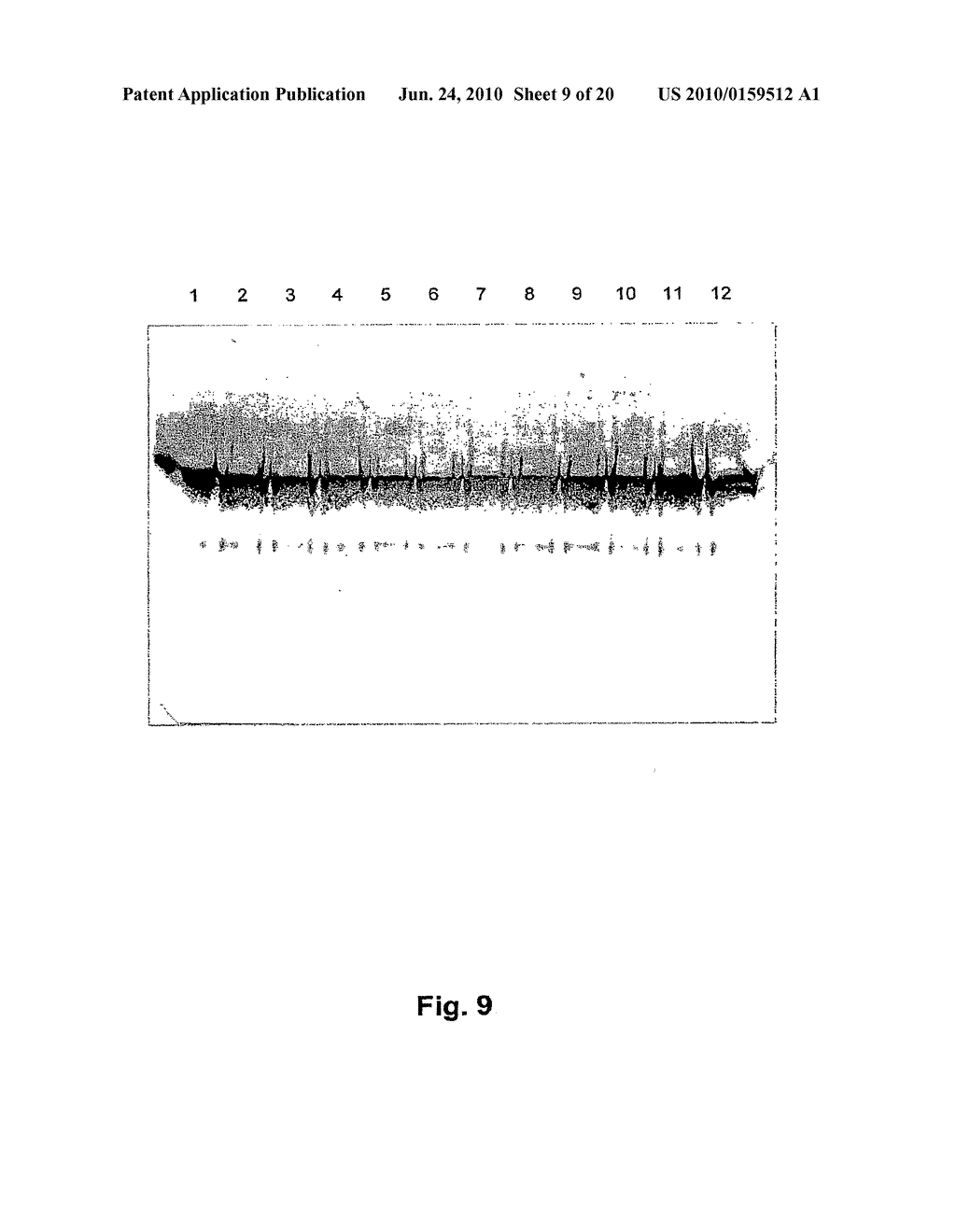 METHOD FOR THE PREPARATION OF RECOMBINANT HUMAN THROMBIN AND FIBRINOGEN - diagram, schematic, and image 10