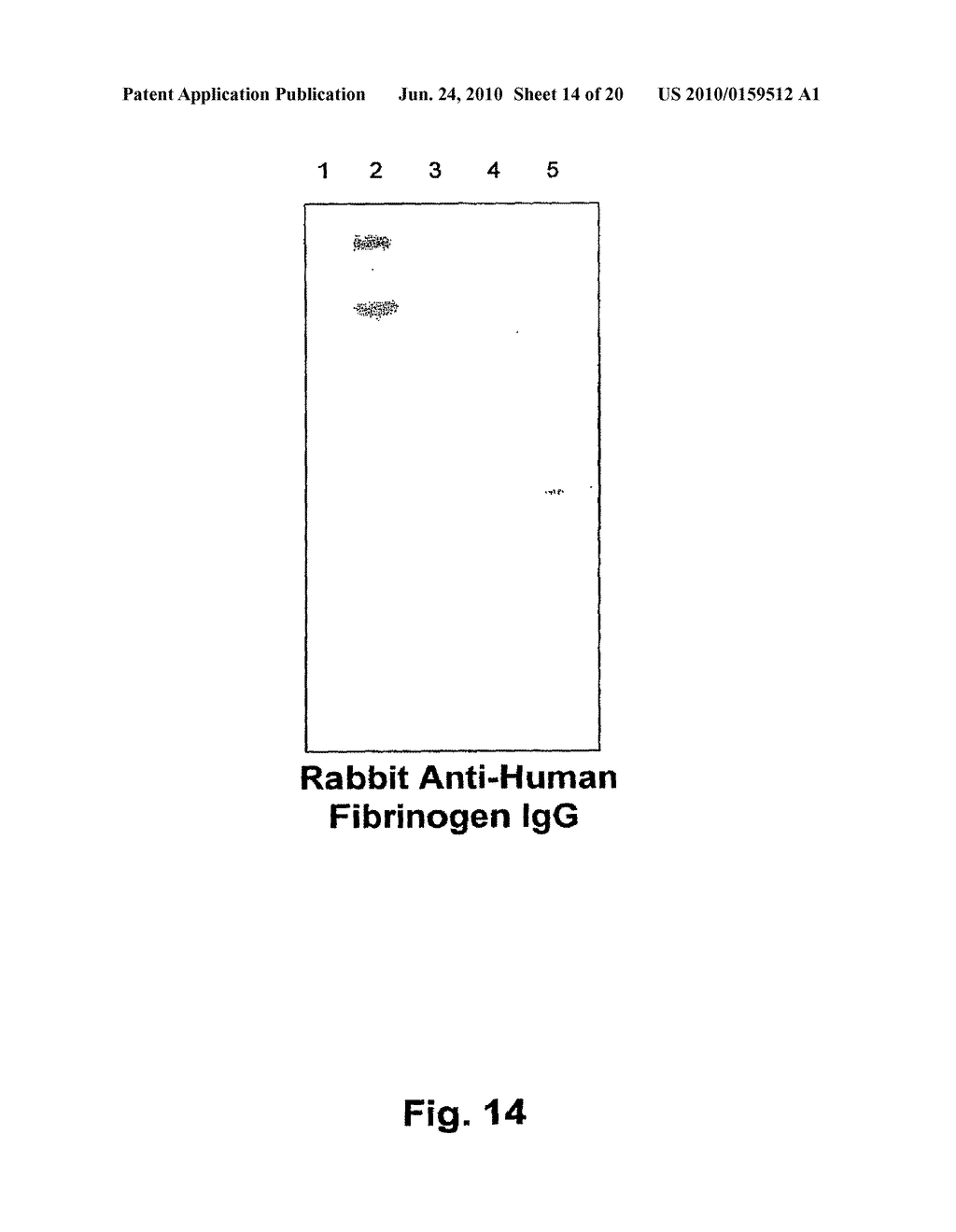 METHOD FOR THE PREPARATION OF RECOMBINANT HUMAN THROMBIN AND FIBRINOGEN - diagram, schematic, and image 15