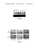 IL1RL-1 AS A CARDIOVASCULAR DISEASE MARKER AND THERAPEUTIC TARGET diagram and image