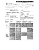 TREATMENT FOR EPILEPSY diagram and image