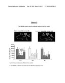 TREATMENT FOR EPILEPSY diagram and image