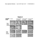 TREATMENT FOR EPILEPSY diagram and image