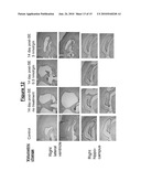 TREATMENT FOR EPILEPSY diagram and image