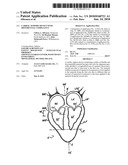 CARDIAC SUPPORT DEVICE WITH DIFFERENTIAL COMPLIANCE diagram and image