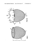 CARDIAC SUPPORT DEVICE WITH DIFFERENTIAL COMPLIANCE diagram and image