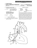 Methods and Devices for Endoscopic Access to the Heart diagram and image