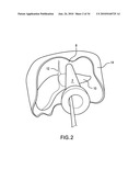 Methods and Devices for Endoscopic Access to the Heart diagram and image