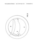 Methods and Devices for Endoscopic Access to the Heart diagram and image