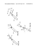 Methods and Devices for Endoscopic Access to the Heart diagram and image