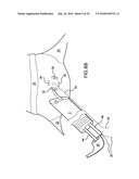 Methods and Devices for Endoscopic Access to the Heart diagram and image