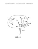 Methods and Devices for Endoscopic Access to the Heart diagram and image