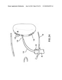 Methods and Devices for Endoscopic Access to the Heart diagram and image