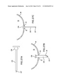 Methods and Devices for Endoscopic Access to the Heart diagram and image