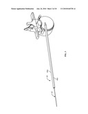 SURGICAL ACCESS SYSTEM AND RELATED METHODS diagram and image