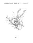 SURGICAL ACCESS SYSTEM AND RELATED METHODS diagram and image