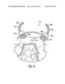 Magnetic surgical retractor diagram and image