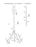 Membrane Layer for Electrochemical Biosensor and Method of Accommodating Electromagnetic and Radiofrequency Fields diagram and image