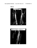 METHOD FOR CONTRAST-AGENT-FREE ANGIOGRAPHIC IMAGING IN MAGNETIC RESONANCE TOMOGRAPHY diagram and image