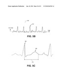 ELECTRODE DATA ANALYSIS TO INDICATE CATHETER STABILITY AND/OR NEEDLE PENETRATION SUCCESS diagram and image